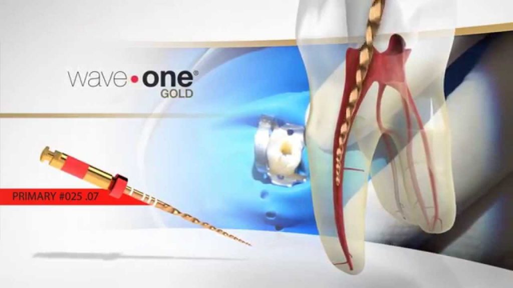 9 WaveOne Gold Files Wave One Files 25mm Primary Endodontic Root Canal